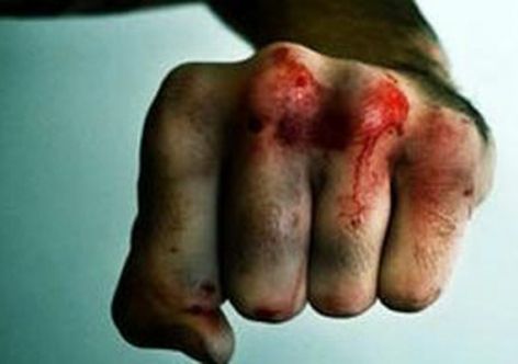 � ��������������� �������� ���� ������� �������