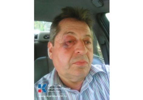 � ����������� ��������� ����� ���������� ����������