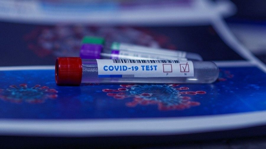 ������ ��������� ����� ������� COVID-19 ������� �� �������