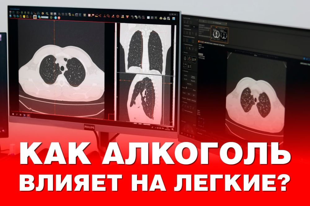 ��� �������� ������ �� ������