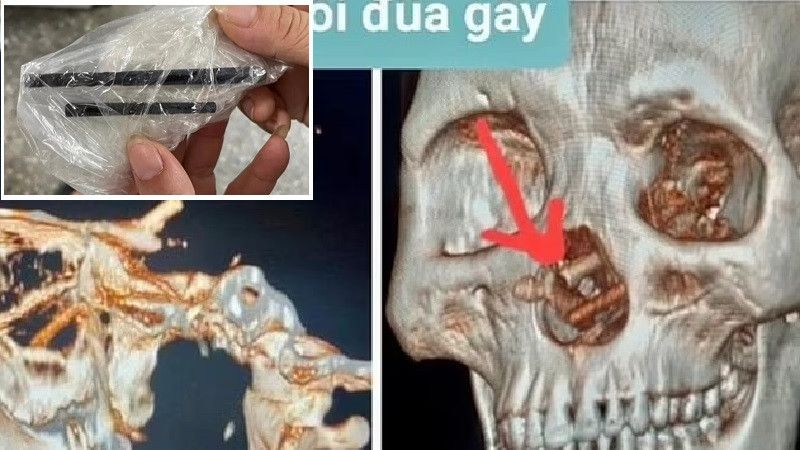 ������� 5 ������� �� ���� �� ��������� �������� � ����� ������