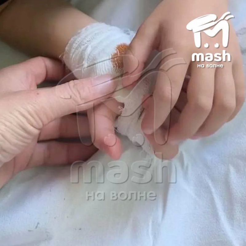 Джек-рассел укусил трёхлетнего малыша на детской площадке в Севастополе